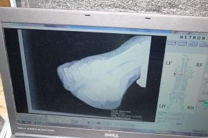 xray on screen